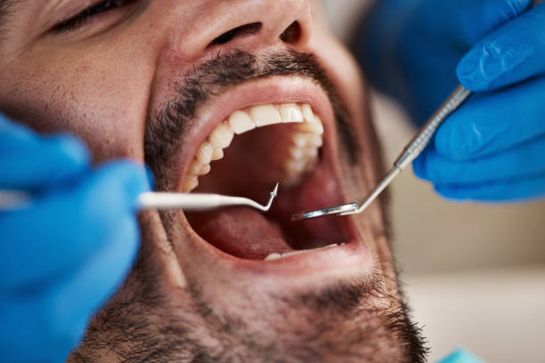 Best Emergency Treatment for Oral Infections in South Palm Beach, FL
